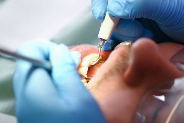 Best Emergency Gum Treatment in Ofallon, MO